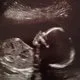 Baby Baby Hochzeitstag?