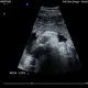 Mein Baby wiegt ungefähr 5 Pfund 14 Unzen ... und deins?