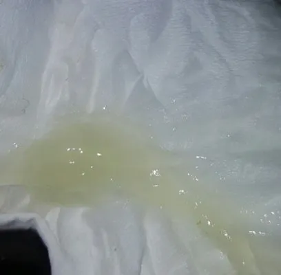 Boca mucosa (foto da Internet)